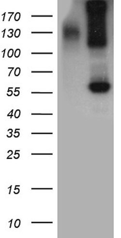 BMP6 Monoclonal Antibody (OTI1B11), TrueMAB , OriGene:Antibodies:Primary