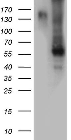 BMP6 Monoclonal Antibody (OTI6G9), TrueMAB , OriGene 100 &mu;L; Unconjugated:Antibodies,