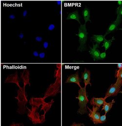 BMPR2 Monoclonal Antibody (3F6F8), Invitrogen 100 &mu;g; Unconjugated:Antibodies,