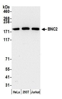 BNC2 Rabbit anti-Human, Polyclonal, Bethyl Laboratories 100 &mu;l; Unlabeled:Antibodies,