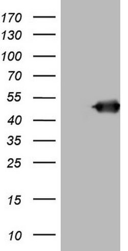 BNIP2 Mouse anti-Human, Clone: OTI1C12, lyophilized, TrueMAB 100 &mu;g;