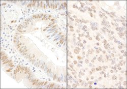 BOP1 Rabbit anti-Human, Mouse, Polyclonal, Bethyl Laboratories 100 &mu;l;