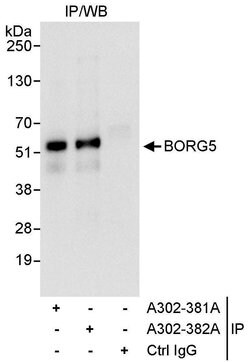 BORG5 Rabbit anti-Human, Polyclonal, Bethyl Laboratories 10 &mu;L; Unconjugated:Antibodies,