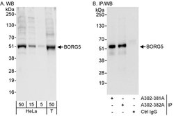 BORG5 Rabbit anti-Human, Polyclonal, Bethyl Laboratories 100 &mu;l; Unlabeled:Antibodies,