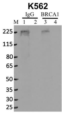 Invitrogen BRCA1 Monoclonal Antibody (MS13) 100 &mu;g; Unconjugated:Antibodies,