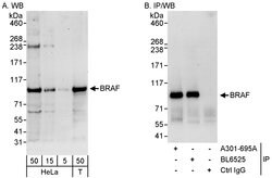 BRAF Rabbit anti-Human, Polyclonal, Bethyl Laboratories 100 &mu;L; Unconjugated:Antibodies,