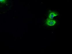 BRAF Mouse anti-Canine, Human, Rat, Clone: OTI3A7, lyophilized, TrueMAB