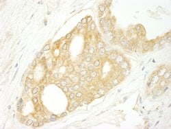 BRAF Polyclonal Antibody, Bethyl Laboratories 10 &mu;l; Unlabeled:Antibodies,