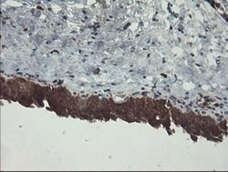 BRAF Mouse anti-Human, Clone: OTI1G8, lyophilized, TrueMAB 100 &mu;g | Buy Online | Origene Technologies | Fisher Scientific