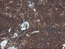 BRAF Mouse anti-Human, Clone: OTI1G8, lyophilized, TrueMAB 100 &mu;g | Buy Online | Origene Technologies | Fisher Scientific