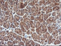 BRAF Mouse anti-Human, Clone: OTI3C3, lyophilized, TrueMAB 100 &mu;g; Unconjugated:Antibodies,