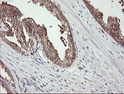 BRAF Mouse anti-Human, Clone: OTI3C3, lyophilized, TrueMAB 100 &mu;g; Unconjugated:Antibodies,