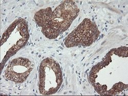 BRAF Mouse anti-Human, Clone: OTI3C3, lyophilized, TrueMAB 100 &mu;g; Unconjugated:Antibodies,