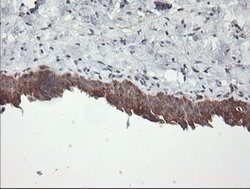 BRAF Mouse anti-Human, Clone: OTI3C3, lyophilized, TrueMAB 100 &mu;g; Unconjugated:Antibodies,