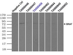 BRAF Mouse anti-Human, Clone: OTI3C3, lyophilized, TrueMAB 100 &mu;g; Unconjugated:Antibodies,