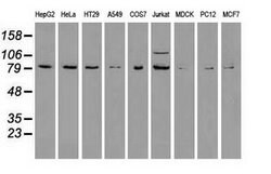 BRAF Mouse anti-Canine, Human, Rat, Clone: OTI3A7, lyophilized, TrueMAB