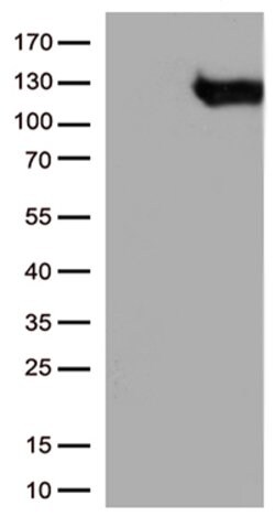 BRAF Mouse anti-Human, Clone: OTI3E8, lyophilized, TrueMAB 100 &mu;g; Unconjugated:Antibodies,