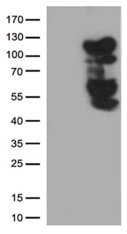 BRAF Mouse anti-Human, Clone: OTI1G8, lyophilized, TrueMAB 100 &mu;g | Buy Online | Origene Technologies | Fisher Scientific