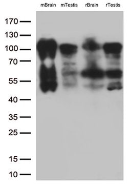 BRAF Mouse anti-Human, Clone: OTI3C3, lyophilized, TrueMAB 100 &mu;g; Unconjugated:Antibodies,