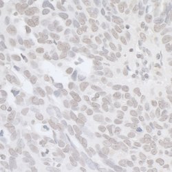 BRCA1 Rabbit anti-Human, Polyclonal, Bethyl Laboratories 100 &mu;L; Unconjugated:Antibodies,