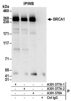 BRCA1 Rabbit anti-Human, Polyclonal, Bethyl Laboratories 100 &mu;L; Unconjugated:Antibodies,
