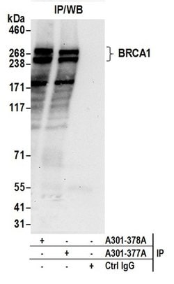 BRCA1 Rabbit anti-Human, Polyclonal, Bethyl Laboratories 100 &mu;L; Unconjugated:Antibodies,