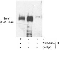BRCA1 Rabbit anti-Human, Polyclonal, Bethyl Laboratories 100 &mu;L; Unconjugated:Antibodies,