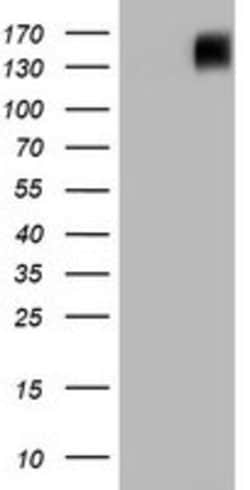 BRCA1 Mouse anti-Human, Clone: OTI2A5, lyophilized, TrueMAB 100 &mu;g;