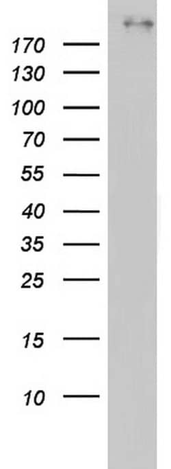 BRCA1 Mouse anti-Human, Clone: OTI2A5, lyophilized, TrueMAB 100 &mu;g;