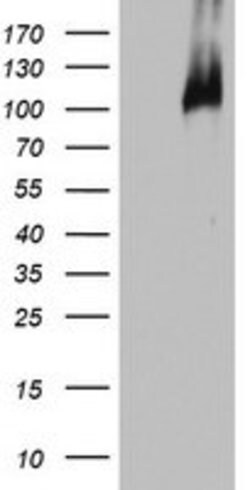 BRCA1 Mouse anti-Human, Clone: OTI6H10, lyophilized, TrueMAB 100 &mu;g;
