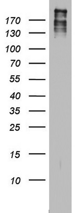 BRCA1 Mouse anti-Human, Clone: OTI6H10, lyophilized, TrueMAB 100 &mu;g;