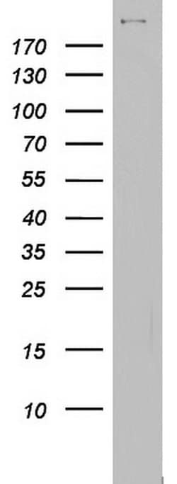 BRCA1 Monoclonal Antibody (OTI7B12), TrueMAB , OriGene 30 &mu;L; Unconjugated:Antibodies,