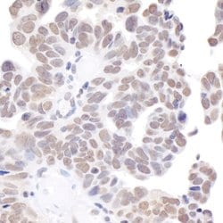 BRD2 Rabbit anti-Human, Mouse, Polyclonal, Bethyl Laboratories 100 &mu;L;