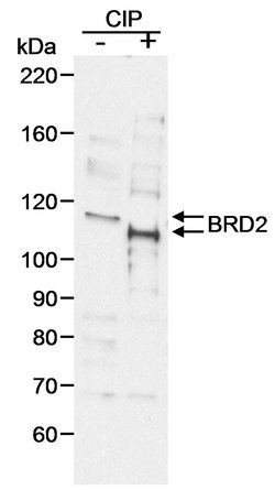 BRD2 Goat anti-Human, Polyclonal, Bethyl Laboratories 100 &mu;L; Unconjugated:Antibodies,