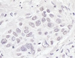 BRD3 Rabbit anti-Human, Polyclonal, Bethyl Laboratories 100 &mu;L; Unconjugated:Antibodies,