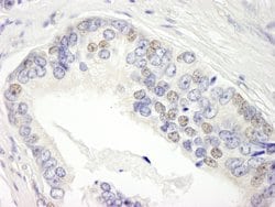 BRD3 Polyclonal Antibody, Bethyl Laboratories 10 &mu;L; Unconjugated:Antibodies,