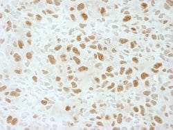 BRD4 Polyclonal Antibody, Bethyl Laboratories 10 &mu;L | Buy Online | Bethyl Laboratories, Inc | Fisher Scientific