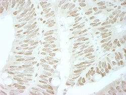 BRD4 Polyclonal Antibody, Bethyl Laboratories 10 &mu;L | Buy Online | Bethyl Laboratories, Inc | Fisher Scientific