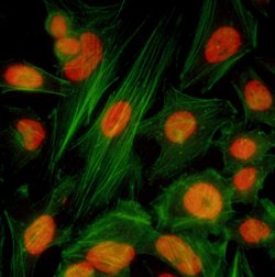 BRD4 Recombinant Rabbit Monoclonal Antibody (BL-149-2H5), Bethyl Laboratories 100 &mu;L | Buy Online | Bethyl Laboratories, Inc | Fisher Scientific