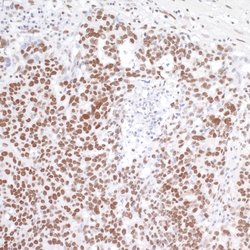 BRD4 Recombinant Rabbit Monoclonal Antibody (BL-149-2H5), Bethyl Laboratories 100 &mu;L | Buy Online | Bethyl Laboratories, Inc | Fisher Scientific