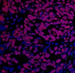 BRD4 Recombinant Rabbit Monoclonal Antibody (BL-151-6F11), Bethyl Laboratories