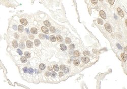 BRD7 Polyclonal Antibody, Bethyl Laboratories 10 &mu;l; Unlabeled:Antibodies,