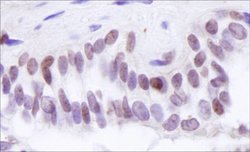 BRD8 Polyclonal Antibody, Bethyl Laboratories:Antibodies:Primary Antibodies