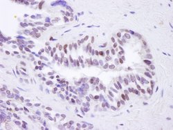 BRD8 Polyclonal Antibody, Bethyl Laboratories 100 &mu;L; Unconjugated:Antibodies,