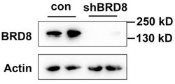 Invitrogen BRD8 Recombinant Rabbit Monoclonal Antibody (1H3L15) 100 &mu;g | Buy Online | Invitrogen&trade; | Fisher Scientific