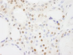 BRF1 Polyclonal Antibody, Bethyl Laboratories:Antibodies:Primary Antibodies