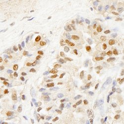 BRF1 Polyclonal Antibody, Bethyl Laboratories 10 μL; Unconjugated:Antibodies,