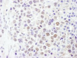 BRG1/SMARCA4 Rabbit anti-Human, Mouse, Polyclonal, Bethyl Laboratories