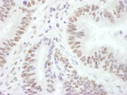 BRG1/SMARCA4 Rabbit anti-Human, Mouse, Polyclonal, Bethyl Laboratories