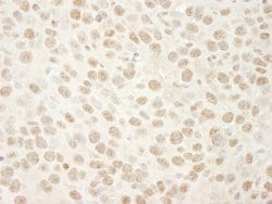 BRG1/SMARCA4 Polyclonal Antibody, Bethyl Laboratories 10 &mu;L | Buy Online | Bethyl Laboratories, Inc | Fisher Scientific